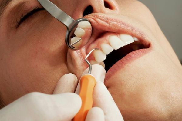 General Dentistry in Thornhill and Richmond Hill - Family Dental Care